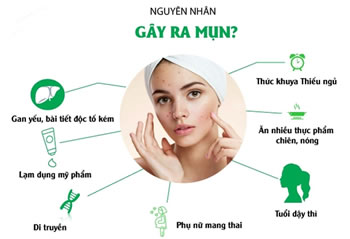 Dịch vụ điều trị mụn uy tín, triệt để tại Hải Dương